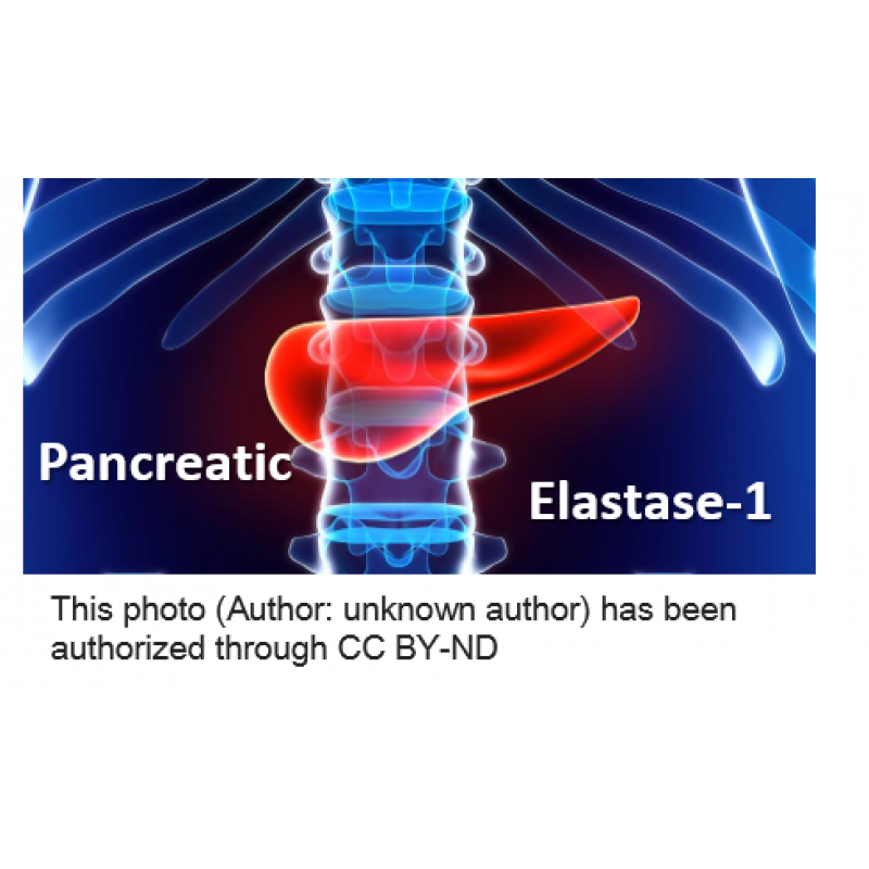 胰臟彈性蛋白酶 (Elastase-1)