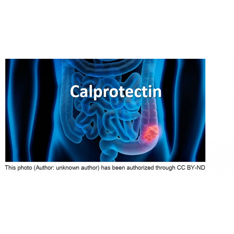 鈣衛蛋白(Calprotectin)