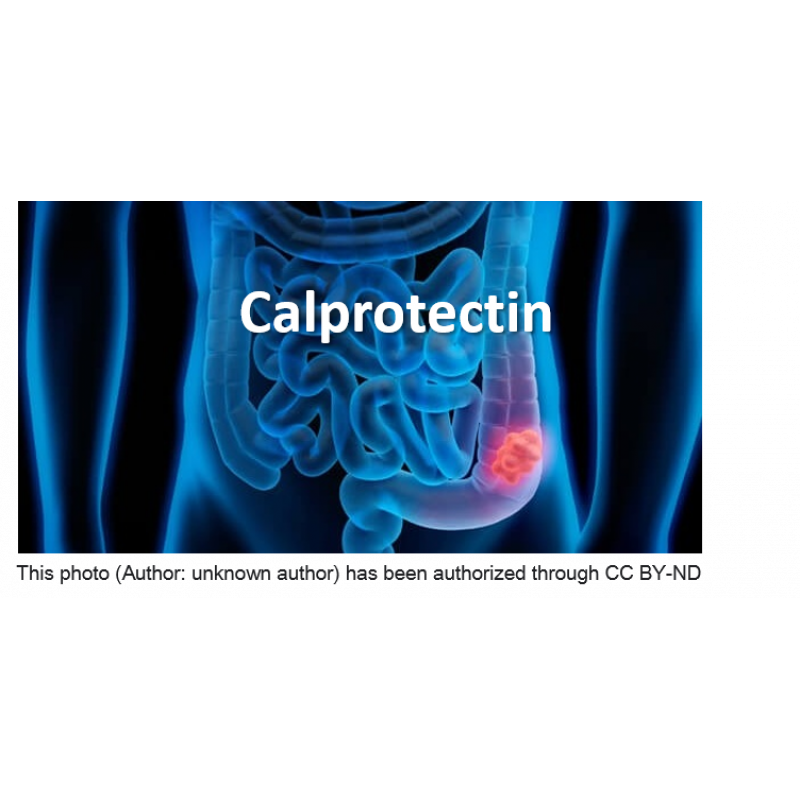 Calprotectin