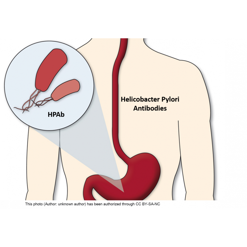 Helicobacter pylori Antibodies (HPAb)