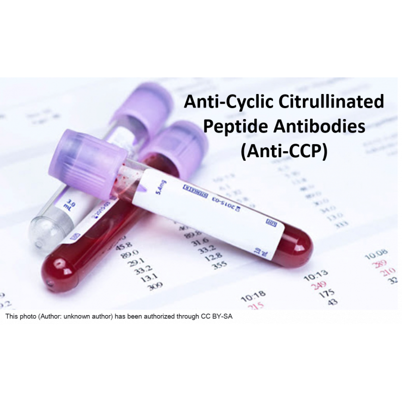 Anti-Cyclic Citrullinated Peptide Antibodies (Anti-CCP)